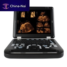 Portable ultrasound system CMS1700Afor multipurpose ultrasound imagingB/W3D/4D