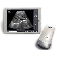 Hand-held ultrasound system SS-1, SS-2for multipurpose ultrasound imagingwireless probe