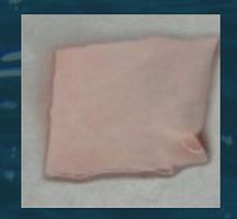 Cardiac tissue matrix allograft