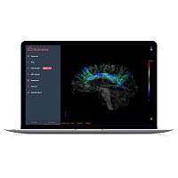 MRI software Brainance MD for neuroimagingfor functional MRIneurosurgery
