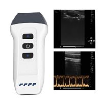 Hand-held ultrasound system DW-L2for musculoskeletal ultrasound imagingfor breast ultrasound imagingfor anesthetic and intensive care ultrasound imaging