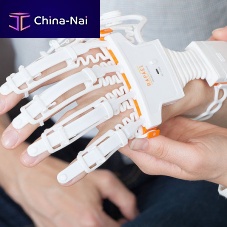 Hand mobility rehabilitation system computer-assisted