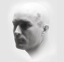 Non-absorbable cranial fixation system