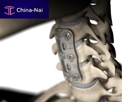 Cervical vertebra arthrodesis plate S-1bioresorbable polymer2 levels1 level