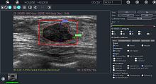 Ultrasound imaging software BU-CADimage analysisreportingdiagnostic