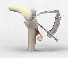 Anterior cruciate ligament reconstruction instrument kit