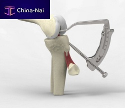 Anterior cruciate ligament reconstruction instrument kit