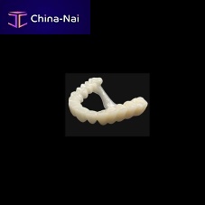 Zirconia dental prosthesis lower incisorremovable