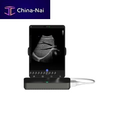 Portable ultrasound system Cloudfor multipurpose ultrasound imagingfor emergency medicine ultrasound imagingfor breast ultrasound imaging