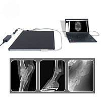 Multipurpose radiography flat panel detector YSFPD-V1717Xportable17 x 17