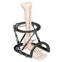 Ankle external fixation system Quartz circularadult