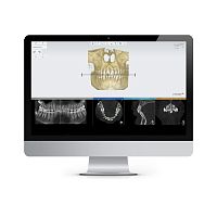 Treatment planning software clinicalorthodonticanalysis