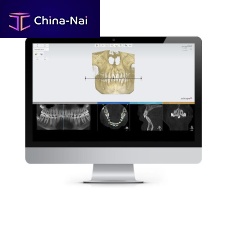 Treatment planning software clinicalorthodonticanalysis