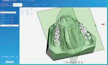 Dental laboratory software for orthodonticsdesignCAD