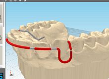 Dental software JawDraw®manufacturing