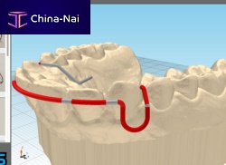 Dental software JawDraw®manufacturing