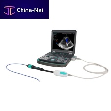 Portable ultrasound system UCC10090T B/Wcolor dopplerbuilt-in console