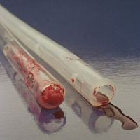Wound drainage catheter AXIOMthoracic