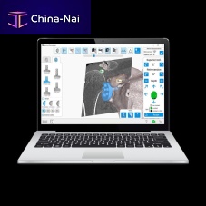 Shoulder prosthesis positioning surgical navigation system Equinoxe®GPS®ARoptical