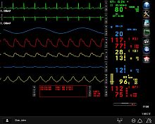 Operating room software monitoringmeasurementalarm