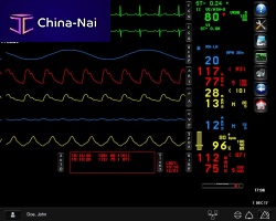 Operating room software monitoringmeasurementalarm
