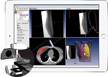Radiation therapy software module EPIgray®radiation dose monitoring