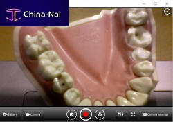 Dental software for controlsharingrecording