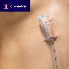 Wound drainage catheter catheter fixation Pleura-Guardwaistadhesive