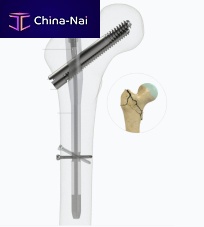 Femoral intramedullary nail 4552-1017proximal fixationrightleft