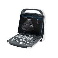Portable ultrasound system DP-10 for multipurpose ultrasound imagingB/Wspectral doppler