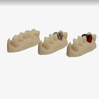 Resin dental material VeriCast for dental restorationscastinggel