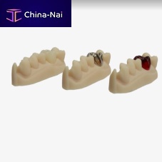 Resin dental material VeriCast for dental restorationscastinggel