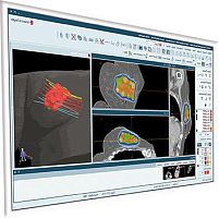 CT software SagiPlan®for MRItreatment planningevaluation