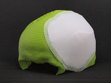 Absorbable cranial implant Osteoplug
