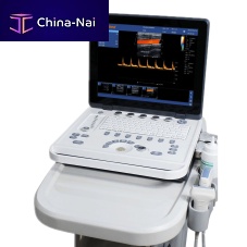 Portable ultrasound system M6for multipurpose ultrasound imagingfor gynecological and obstetric ultrasound imagingfor abdominal and pelvic ultrasound imaging