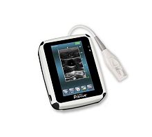 Hand-held ultrasound system SITE-RITE PREVUE+®for anesthetic and intensive care ultrasound imagingB/Wtouchscreen
