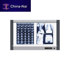 Digital X-ray film viewer MG-022-screenwhite lightwith switch