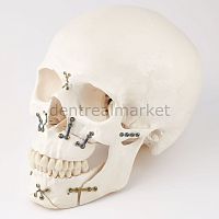 Maxillofacial compression plate 56.10.116Ametallic