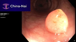 Universal software surgicaloperating roomvisualization