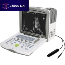 Portable ultrasound system WED-5100for ophthalmic ultrasound imagingB/W12-inch