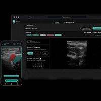 Ultrasound imaging software training