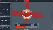 Dental software Twim analysisdiagnostic3D viewing