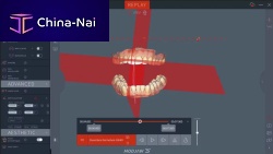 Dental software Twim analysisdiagnostic3D viewing