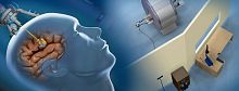 Brain tumor treatment laser ablation system NeuroBlate®MRI-guided