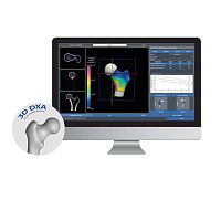 Bone densitometry software 3D-DXA3D viewing