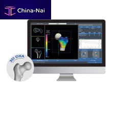 Bone densitometry software 3D-DXA3D viewing