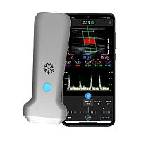 Hand-held ultrasound system H35Lfor emergency medicine ultrasound imagingfor breast ultrasound imagingfor musculoskeletal ultrasound imaging