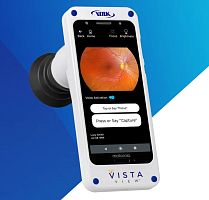Mydriatic retinal camera vistaviewhand-held