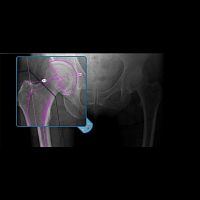 Medical software OrthoViewclinicalsurgeryanalysis