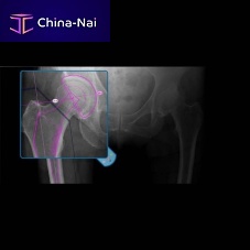 Medical software OrthoViewclinicalsurgeryanalysis